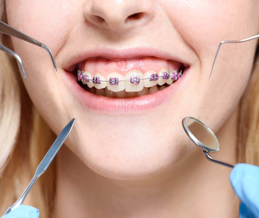 Orthodontist Singapore